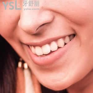 四川成都圣貝牙科金屬自鎖矯正價(jià)格超低優(yōu)惠