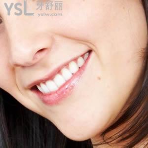 來(lái)看一下成都圣貝牙科正雅隱形矯正價(jià)格表