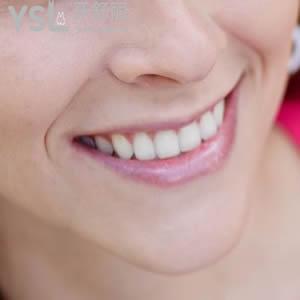 杭州維多利亞口腔醫(yī)院冷光美白價格超低優(yōu)惠來嘍