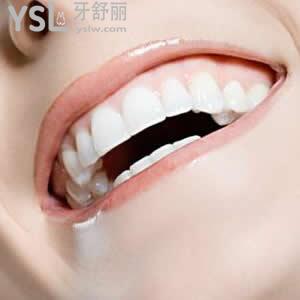北京圣貝口腔價目表全瓷牙優(yōu)惠活動來嘍！