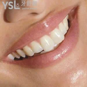 成都極光口腔價(jià)格表隱適美隱形矯正暑期活動(dòng)優(yōu)惠