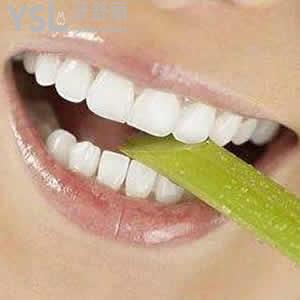 成都極光口腔價(jià)格表MRC咬合誘導(dǎo)暑期超低優(yōu)惠活動(dòng)來(lái)襲！