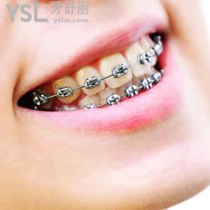 北京圣貝口腔價目表樹脂補牙超低優(yōu)惠價格來襲！