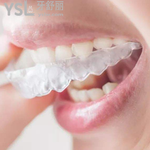 保定合眾口腔收費(fèi)標(biāo)準(zhǔn)之隱形矯正多少錢？?jī)r(jià)格貴嗎？