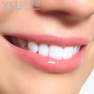 沈陽歡樂仁愛口腔醫(yī)院收費標(biāo)準(zhǔn)之隱形矯正暑期價格多少錢？