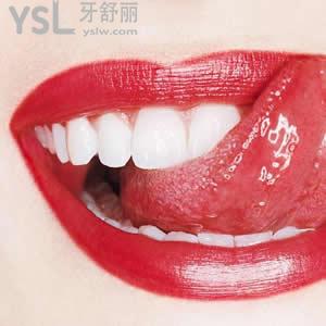 廣州圣貝口腔之超聲波潔牙價(jià)格大概多少錢？