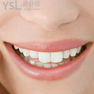 青島牙博士口腔門診部?jī)r(jià)目表之隱形矯正價(jià)格貴嗎？