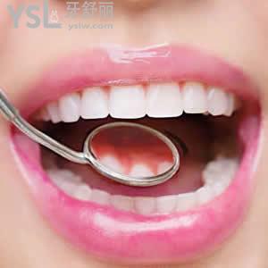 寧波牙博士口腔價格表之全瓷牙優(yōu)惠價格