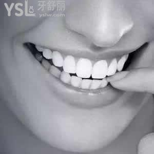 南通牙博士口腔門(mén)診部?jī)r(jià)格表之鑄瓷嵌體貴嗎？