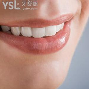 超低價(jià)！昆明美奧口腔醫(yī)院之正雅全隱形矯正優(yōu)惠活動(dòng)來(lái)咯！