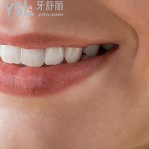 深圳美奧口腔醫(yī)院收費貴嗎？深圳美奧種植牙多少錢？