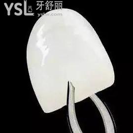 鄭州拜博口腔醫(yī)院價格貴嗎？牙齒貼片鑄瓷貼面驚爆價來了！