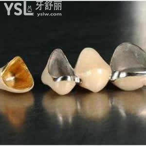 鄭州拜博口腔醫(yī)院醫(yī)院收費標準，烤瓷牙生物鈷鉻合金烤瓷牙活動來啦。