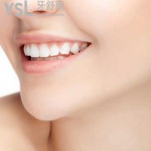 鄭州拜博口腔之牙齒美白實力巨惠，安排