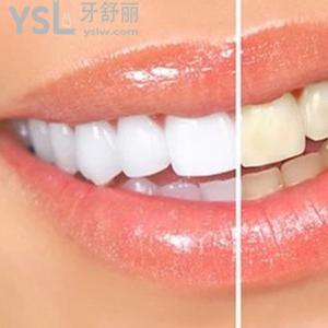 長沙口腔醫(yī)院哪家好？長沙好大夫之皓齒美白價(jià)格表收費(fèi)一覽