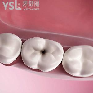 根管治療磨牙原價和現(xiàn)價各是多少？珠海九龍口腔醫(yī)院收費標準