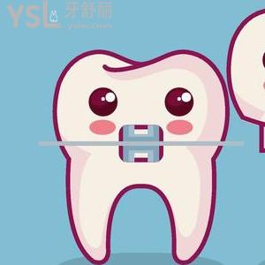 成都新橋口腔之進(jìn)口極速自鎖貴嗎？去過(guò)的都說(shuō)不要太劃算