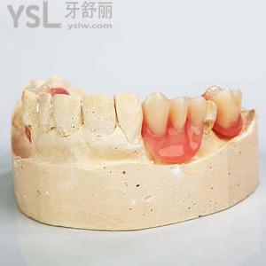 上假牙多少錢(qián)一顆？