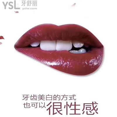 冰瓷牙貼面能維持多久？