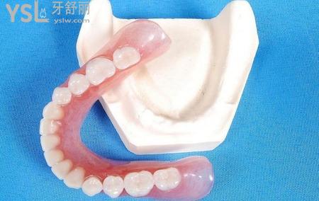 固定義齒修復(fù)的缺點(diǎn)有哪些？