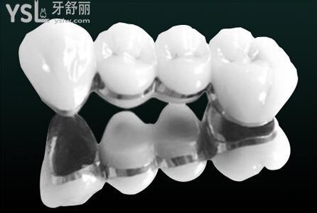 鑲牙的材料與價格多少錢？