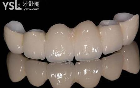 全瓷牙和二氧化鋯區(qū)有什么不一樣？