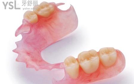 什么是半固定義齒？