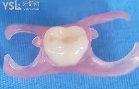 固定義齒的禁忌癥有哪些？