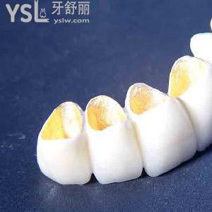 北京做了牙冠多少錢？