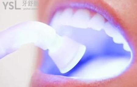 牙齒美白要多少錢？