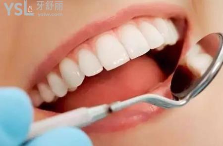 冷光美白牙齒需要注意什么？