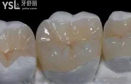 補牙用什么材料？