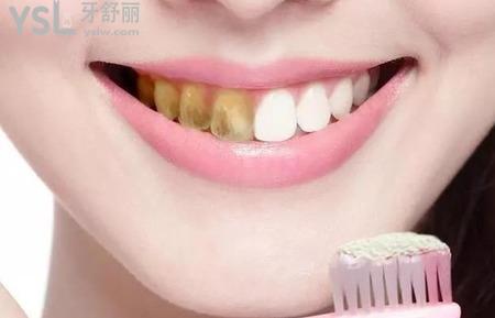 牙齒發(fā)黃怎么變白？