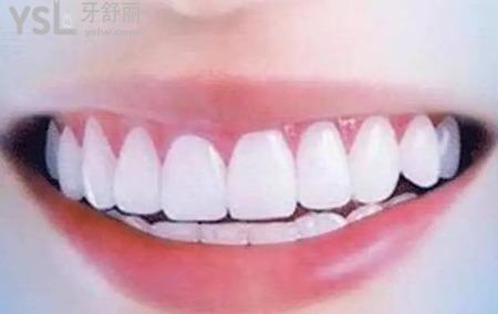 牙性前突和骨性前突的區(qū)別在那？