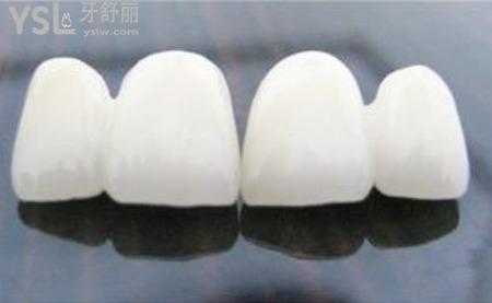 烤瓷牙有什么后遺癥？