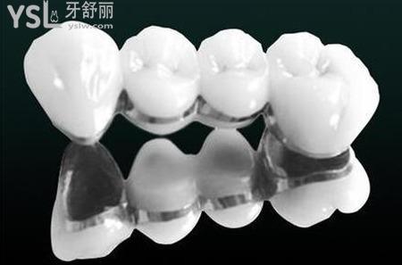 帶烤瓷牙能不能用電動牙刷？