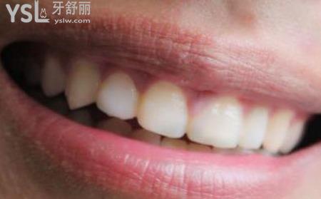 牙發(fā)軟是什么原因？