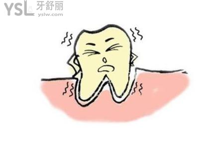 牙齒3度松動還能保嗎？