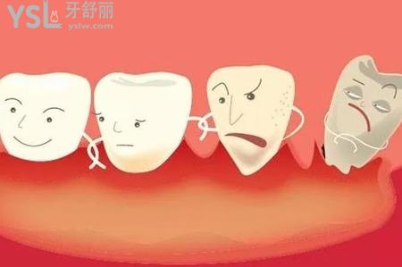 牙周病用什么牙膏好？