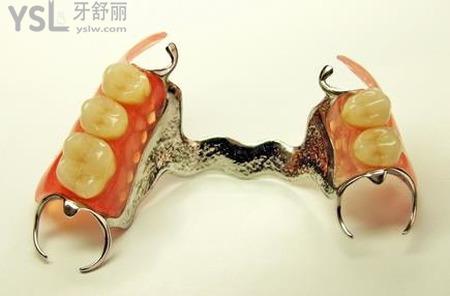 活動(dòng)假牙和固定假牙哪個(gè)比較好？