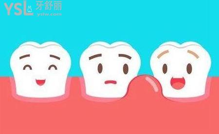 牙周炎導(dǎo)致牙齦萎縮怎么？