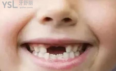 牙齒掉了多久能長出來？