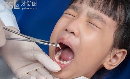 半夜突然牙痛是怎么回事？