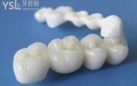下牙齒掉了一顆,需要補(bǔ)一顆嗎？
