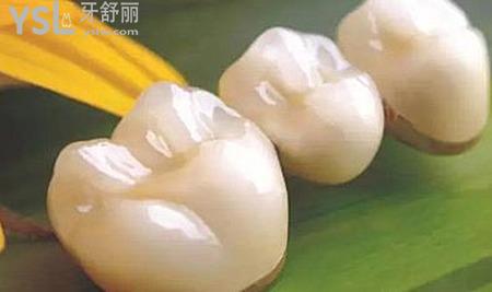 我是該補(bǔ)牙還是做烤瓷牙哪一個(gè)好？