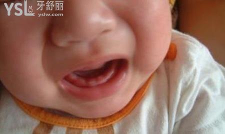 小孩九個(gè)月孩還沒有長牙,是什么原因?