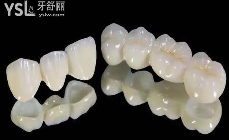 一般的全烤瓷牙多少錢一顆？
