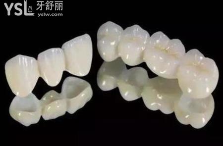 拔牙之后如果不補牙有什么影響？