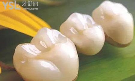 全瓷牙可以洗牙嗎？
