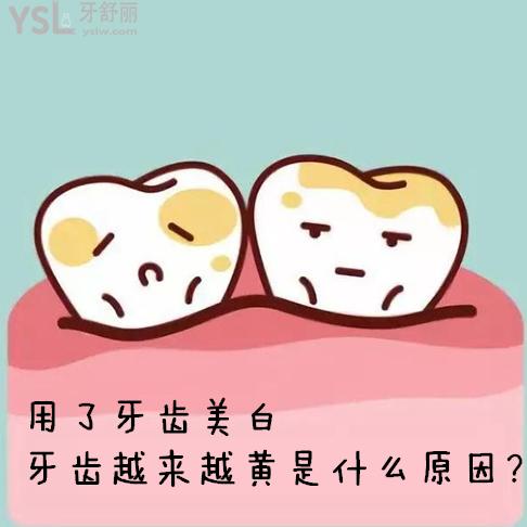 好苦惱！用了牙齒美白牙齒越來越黃是什么原因？